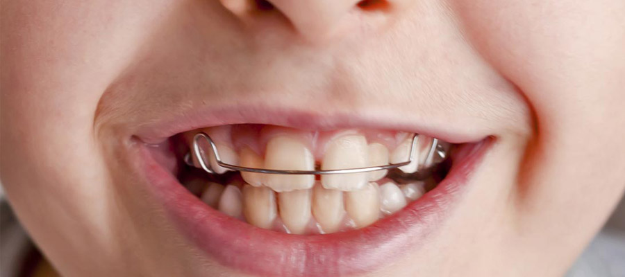 l'orthodontie pour enfant